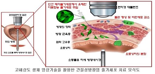 자료 : 서울아산병원