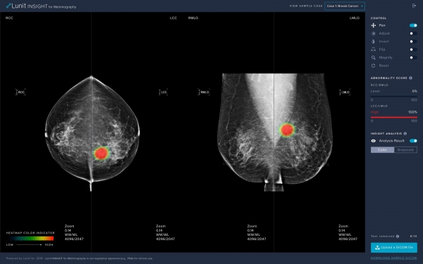                            유방암 진단 보조 인공지능 소프트웨어 루닛 인사이트 MMG 의 웹사이트 화면