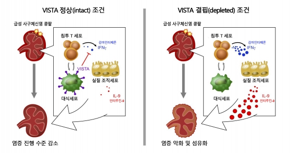 [VISTA 결핍 여부에 따른 급성 사구체신염의 콩팥 섬유화 매커니즘 모식도] VISTA 결핍 마우스의 콩팥은 콩팥 침투 T세포가 사이토카인으로서 인터페론감마를 과다 분비하고, 이에 영향을 받아 콩팥의 고유 기능을 담당하는 실질세포가 또 다른 사이토카인인 인터루킨-9을 과다 발현하여 섬유화가 더 진행한다. 논문 발췌 번역 [J Clin Invest 2022;132(1):e151189]