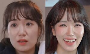 '나는 솔로' 30기 옥순, 방송 후 확 달라진 비주얼 비결... 고우리 시술 ... - 뉴스 썸네일 이미지